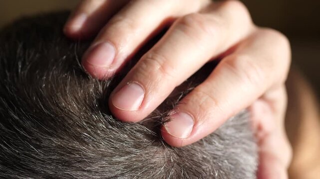 Close-up of man massaging scalp with fingers, promoting relaxation and stress relief. Concept of self care, wellness routine and mens grooming, improving mental health and daily well being.