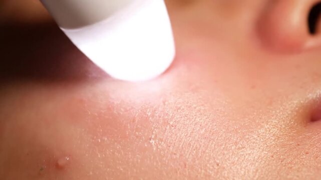 Advanced Skincare Treatment Close-Up Showing Device Application for Glowing and Healthy Skin Surfaces in a Professional Beauty Setting