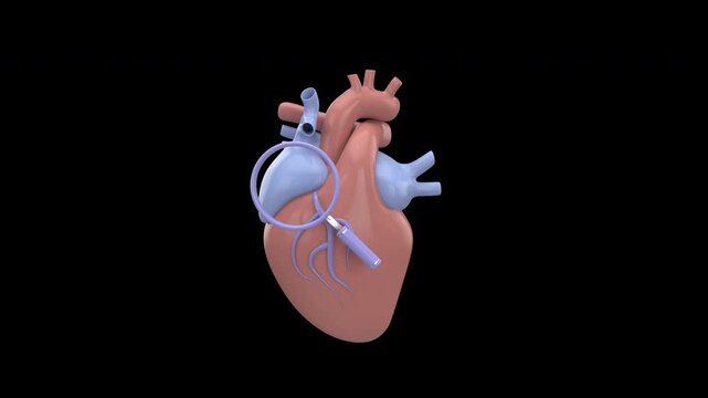 3D human heart with magnifying glass highlighting infection or disease, symbolizing medical diagnosis or cardiology research with alpha channel