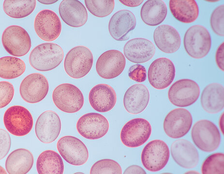 A microscopic view reveals a dense field of red blood cells, showcasing their characteristic biconcave disc shape against a light blue background.