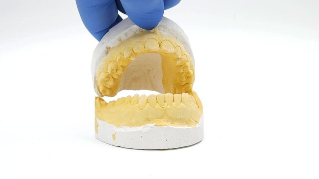horizontal video of a plaster cast of the jaw in preparation for the installation of braces on the teeth on a white background. Dental care theme