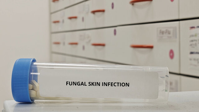 FUNGAL SKIN INFECTION treatment tablets for eliminate dermatophyte infections antifungal therapy