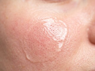 Fototapeta premium Close up of woman's skin with product applied, texture details and pores visible.