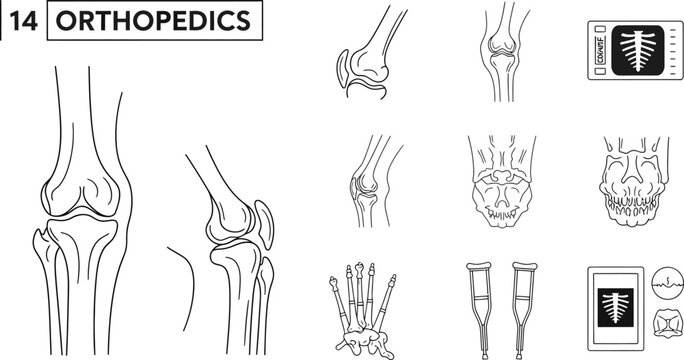 Set of Orthopedic Medical Illustrations Showing Skeletal Anatomy and Diagnostic Tools.