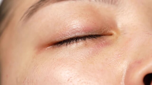 Close-Up Of A Woman's Eye During Cosmetic Makeup Application In A Spa Setting Highlighting Smooth Skin Texture