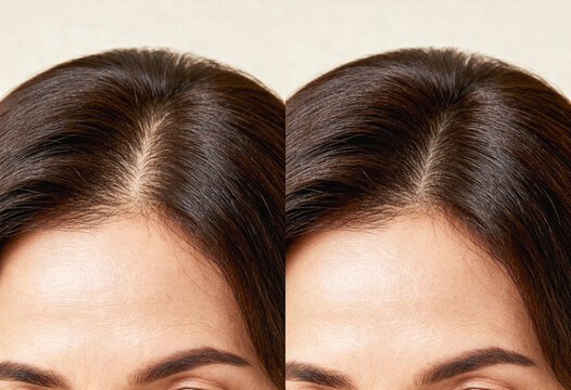 Split composition showing a closeup of a woman's forehead with smooth, even skin and parted dark brown hair, emphasizing hair texture and natural lighting in a neutral setting