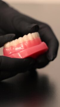 Dental aligners placement on jaw model orthodontic demonstration
