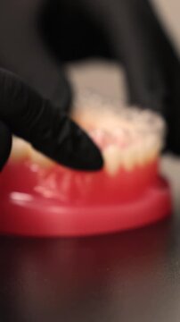 Dental aligners placement on jaw model orthodontic demonstration