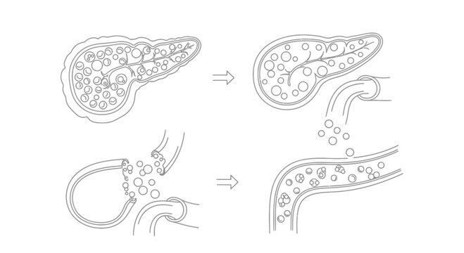 Pancreatic Enzyme Secretion Diagram: Digestion Process