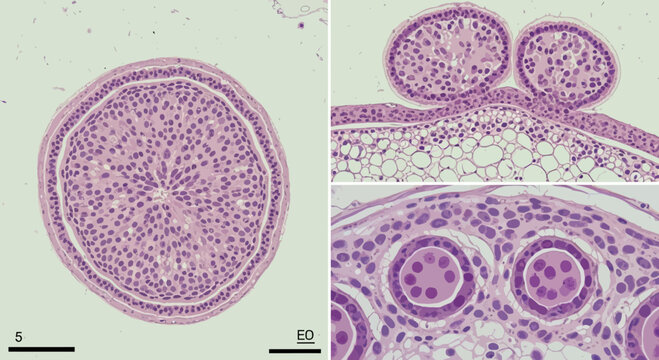 Microscopic view of cross-section of seminiferous tubules and cross-section of epididymis