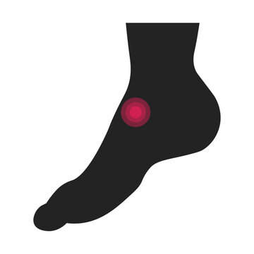 Isolated silhouette illustration of painful instep for health icons in clinics and neurologists.