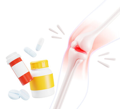 Knee anatomy 3D model with pill bottles, tablets, medicine drugs for inflammation and pain relief. Red glowing area indicates arthritis or injury. Vitamin or supplement capsules jar