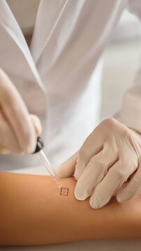 Clinician performing skin-prick test on patient's forearm for pet allergy diagnosis in clean clinic, close-up medical procedure