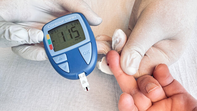 Glucometer reading and finger prick blood sample during clinic glucose test