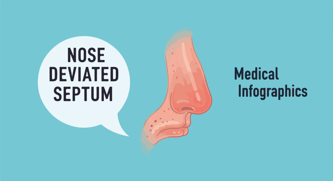 Illustration of a nose with a deviated septum and text "Medical Infographics