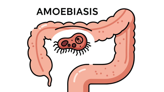 Amoeba Infection Within the Human Intestine