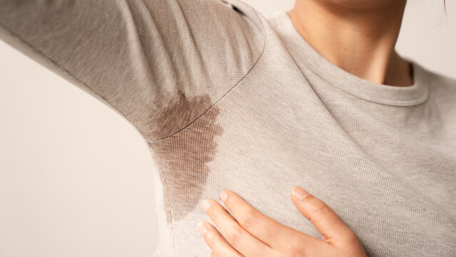 Close-up  woman with hyperhidrosis sweating