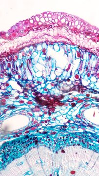 Pine bark histology section under the microscope. Gymnospermae bark section