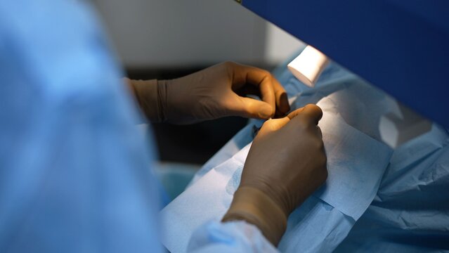Close up of surgeon's hands in gloves performing ophthalmic surgery. Doctor uses medical instrument on patient's eye under a laser machine. Modern clinic and advanced technology in medicine