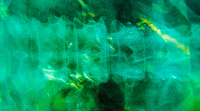 Spine xray with grunge texture and distressed overlay. Abstract medical background showing vertebrae anatomy, radiology scan with vintage noise and dust effect.