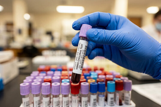Medical worker holding blood sample tube labeled vibrio cholerae test in busy diagnostic lab