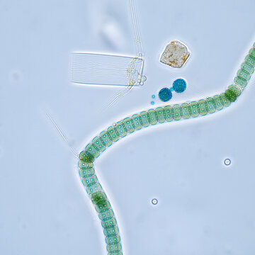 Microscopic view of Anabaena cyanobacteria showcasing cytoskeleton and CorMR system during cell morphogenesis.