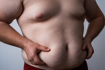 Naklejka premium Belly fat shows weight gain. Fat belly shows excess weight. Large belly shows poor diet. Abdominal fat shows sedentary lifestyle.
