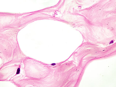 Under an optical microscope, the adipocytes appear as large vacuoles with flattened nuclei located at the cell edge. These are adipocytes from a woman's resting mammary gland. Magnification: 1000&times;
