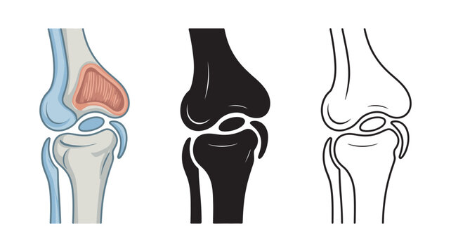 Human knee replacement surgery icons illustrating joint anatomy, prosthetic implant design, orthopedic reconstruction, and medical rehabilitation concept.