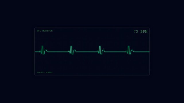 Medical ECG monitor interface displaying a normal heart rate of seventy beats per minute on dark screen