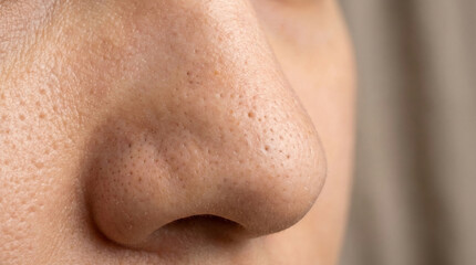 Fototapeta premium Close-up nose with visible pores and blackheads on neutral background with copy space words + concept