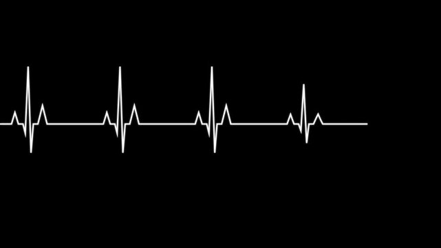 Flatline heartbeat ecg monitor medical emergency concept on black background minimalist design