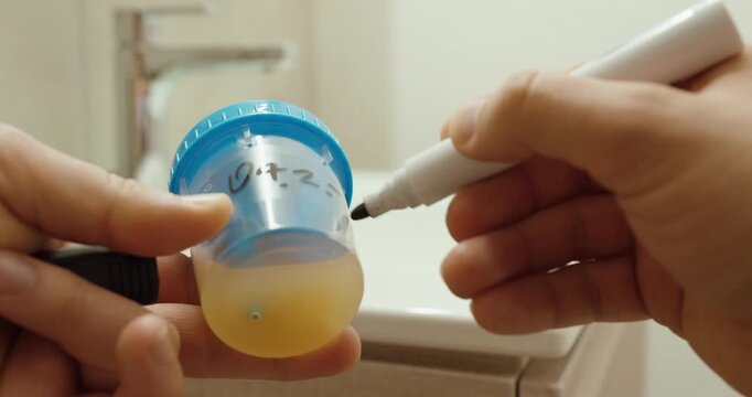 Close-up of a person labeling a urine sample container with a marker, showing proper identification in medical testing.