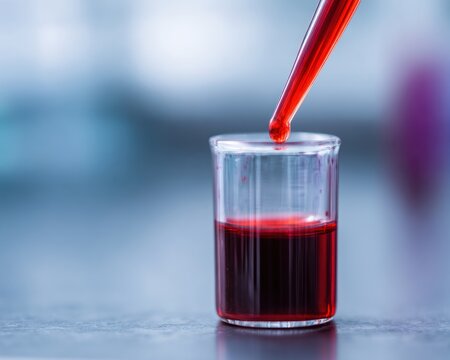 pipette dripping red liquid into small glass laboratory beaker on blurred background representing polycythemia testing process and clinical research concept