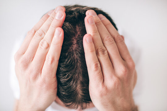 Young man isolated over white background. Close up picture of head. Hair problem falling down. Hold hands on head. Dandruff on head skin.