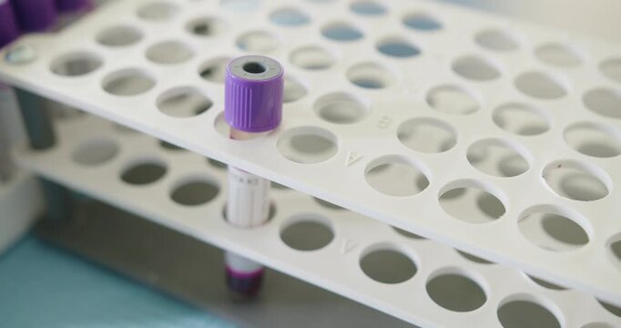Close-up of a gloved hand placing a blood sample vial labeled 'edta' into a slot in a white laboratory tray. Gloved Hand Inserting a Blood Sample into Medical Lab Tray