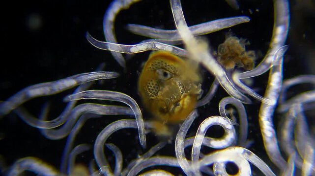 Aggregation of nematodes showing slow movement under 100x magnification, dark field microscopy. 4K scientific microscopy footage.