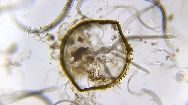 Large group of nematodes moving slowly with insect chitin structure in center under 100x magnification, bright field microscopy. 4K scientific microscopy footage.