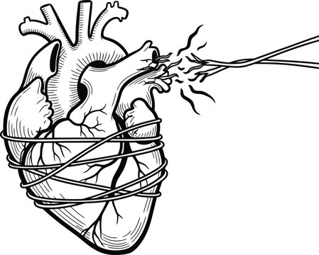 Adobe Illustrator ArtworkAnatomical human heart illustration tied with wire and sparking electrical cables disconnected from arteries for technology and health concept.