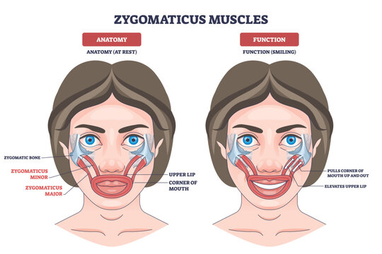 Zygomaticus muscles outline explains smile mechanics, showing major and minor elevating upper lip and mouth corners, focus on zygomaticus major, zygomaticus minor, upper lip. Diagram