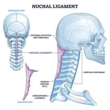 Nuchal ligament outline illustrates its path from external occipital protuberance to cervical vertebrae, key objects, skull, cervical spine, ligament. Outline diagram