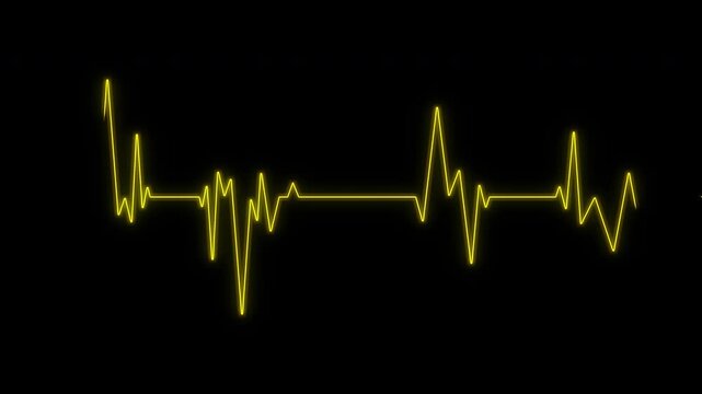 Heartbeat flatline showing neon yellow heart rate on black background suitable for medical, healthcare, emergency, and cardiacthemed designs. 4K Video
