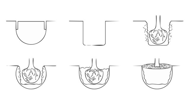 Tree Planting Instructions Step by Step Guide Illustration. Linear icon set showing the process of digging a hole, placing root ball, backfilling soil, and planting a new tree in the garden yard.