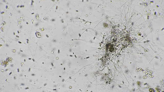 Algae trapping organisms. Entangled filaments harbor moving protozoa and debris within detailed matrix. Dense web of algae filaments provides habitat for motile protozoa and particulate matter