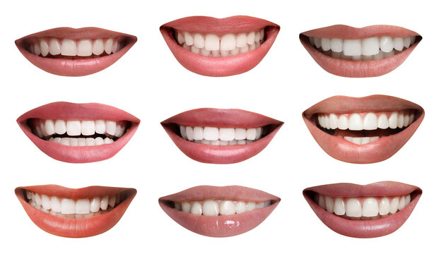 Dental care. Women with healthy teeth, collage of smiles on white background