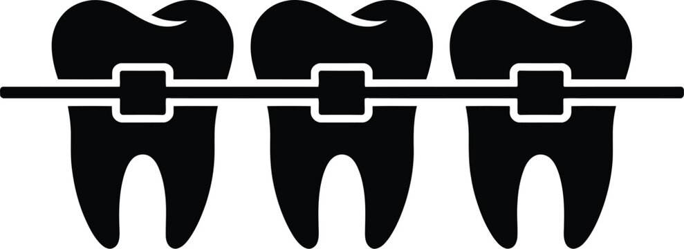 Dental braces on teeth vector, illustration, orthodontic orthodontics braces system representing teeth straightening alignment and oral care treatment.