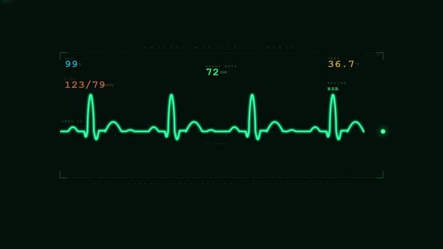 Medical patient monitor with green ECG heart rate waveform and vital signs cardiac display