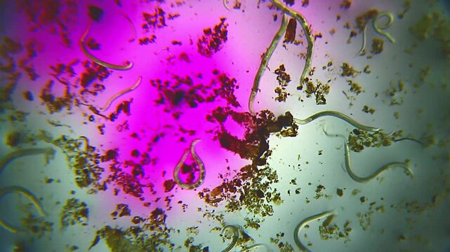 Nematodes moving in potassium permanganate solution under 40x magnification brightfield microscopy. 4K scientific microscopy footage.