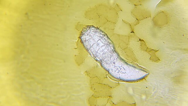 Demodex brevis mite with visible body and chitin structure under 400x magnification brightfield microscopy. 4K scientific microscopy footage.
