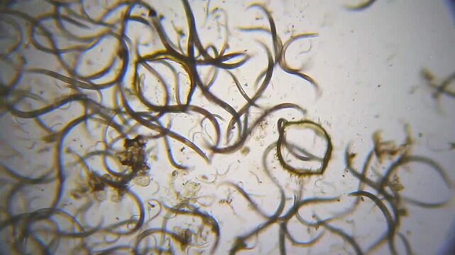 Nematodes aggregation moving rapidly under 40x magnification brightfield microscopy. 4K scientific microscopy footage.